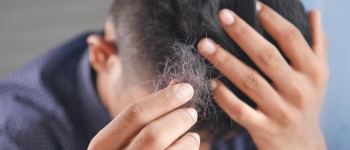 Натуральний підсолоджувач прискорює лікування облисіння