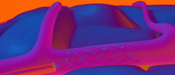 Крихітний стартап виграв перегони за тестування імплантату мозку на людях