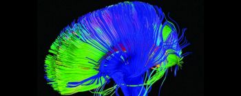 Нейробіологи намагаються змінити наші мозкові ланцюги, щоб викорінити біль