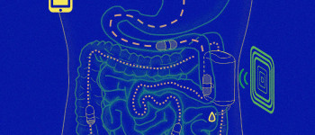 Нове лікування діабету має робота, «закріпленого» всередині вашого кишечника