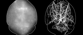 Нова техніка мікроскопії дозволяє заглядати в мозок без хірургічного втручання