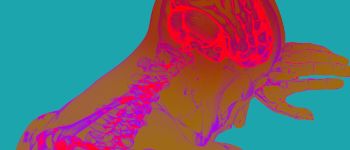 Нове дослідження може повернути пам'ять у пацієнтів з хворобою Альцгеймера