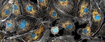 Нове дослідження показує, як мітохондрії страждають від хвороби