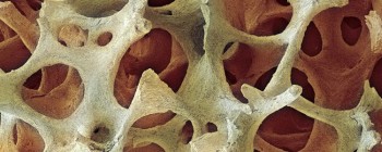 Нова методика дозволяє відростити кістки