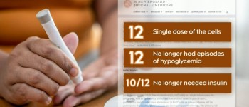Жінці більше не потрібен інсулін після однієї дози експериментальних стовбурових клітин