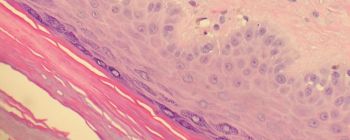 У вашому тілі є невідкритий орган, і він може пояснити, як поширюється рак