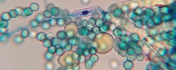 Дослідники виявили барвник, який безпечний і ефективний при лікуванні малярії