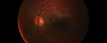 Дослідники, можливо, виявили спосіб вилікувати сліпоту