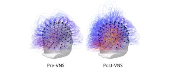 Дослідники відновлюють свідомість у людини після 15 років у вегетативному стані