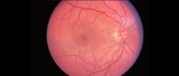 Імплантат сітківки відновлює зір у сліпих мишей