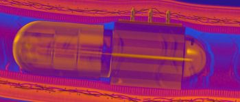 Робо-пігулка проколює стінки кишечника для доставлення ліків