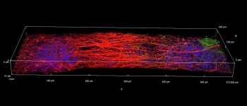 Вчені видрукували на 3D-принтері функціональну тканину головного мозку людини