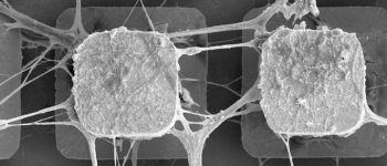 Вчені вживлюють клітини людського мозку в мікрочипи