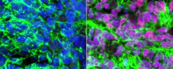 Вчені перетворили людські стовбурові клітини на сенсорні нейрони