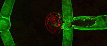 Вчені створили першу у світі "живу" аневризму мозку людини