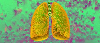 Вчені знаходять мікропластик всередині людських органів