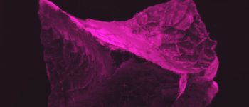 Вчені знайшли збережені клітини мозку древньої людини, розчавленої вулканом