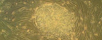 Вчені вперше виростили робочий людський м'яз зі стовбурових клітин