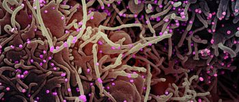 У вчених з'явилася багатообіцяюча ідея як перемогти коронавірус