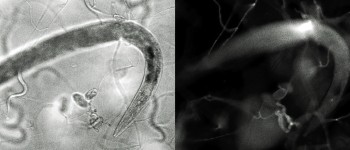 Вчені заінтриговані м'ясоїдним грибом, що пожирає хробаків