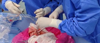 Вчені вперше пересадили людині легені свині