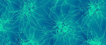 Крихітні срібні дроти демонструють «мозкоподібні» властивості