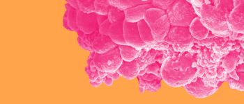 Вчені випробують нове лікування раку на людях у 2019 році