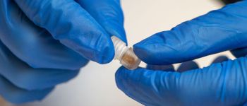 Невеличкий пристрій зішкребе ваші кишкові бактерії для виявлення ознак неприємностей