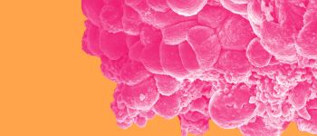 Деякі пацієнти з раком молочної залози можуть відмовитись від хіміотерапії