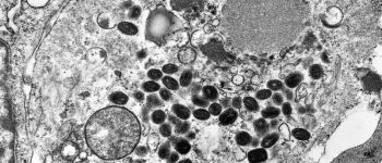 УПМ схвалило новий препарат проти чергової пандемії віспи