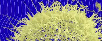 ВООЗ шукає хворобу, яка може стати наступною глобальною пандемією