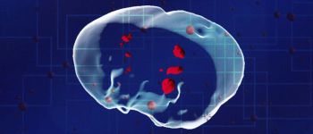 Вчені впевнені, що наноботи можуть вбивати окремі ракові клітини