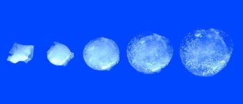 Ця розумна пігулка стає в 100 разів більше у вашому шлунку