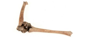 Археологи досліджують ставлення до людей з інвалідністю в пізньому Середньовіччі