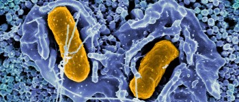 Вчені розробили сальмонелу, яка може підвищити виживання при раку товстої кишки