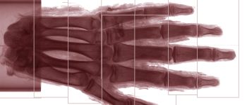 Тепер ми можемо бачити окремі клітини в руці цієї мумії