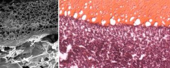 У нас є клей, який може запечатувати рани всередині людського тіла