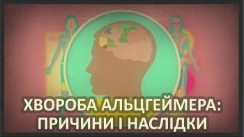 Хвороба Альцгеймера: причини і наслідки