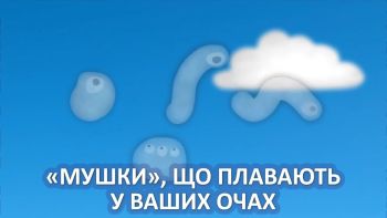 "Мушки", що плавають у ваших очах