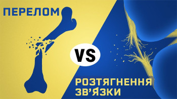 Що гірше: перелом чи розтягнення зв’язок?