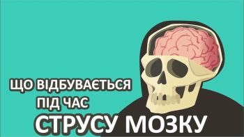 Що відбувається під час струсу мозку