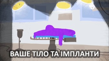 Ваше тіло та імпланти