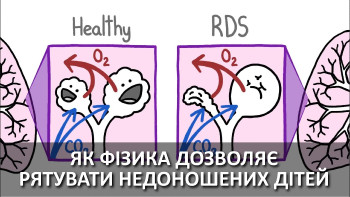 Як фізика дозволяє рятувати недоношених дітей