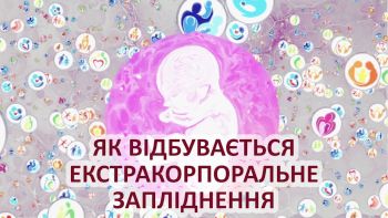 Як працює екстракорпоральне запліднення