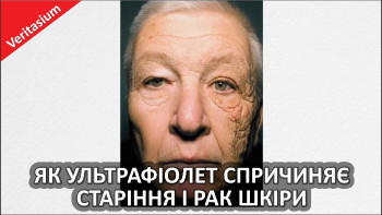 Як ультрафіолет спричиняє старіння і рак шкіри