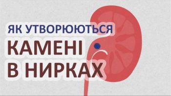 Як утворюються камені в нирках