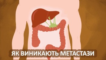 Як виникають метастази